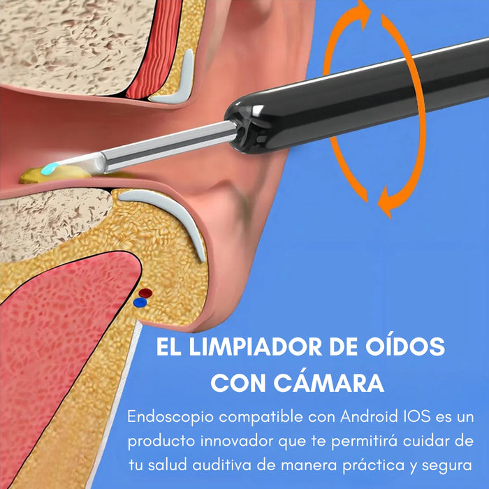 Limpia Oídos Cámara Inteligente Extractor De Cera Endoscopio