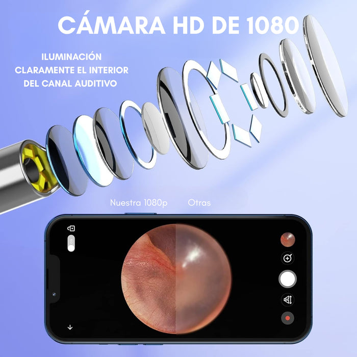 Limpia Oídos Cámara Inteligente Extractor De Cera Endoscopio