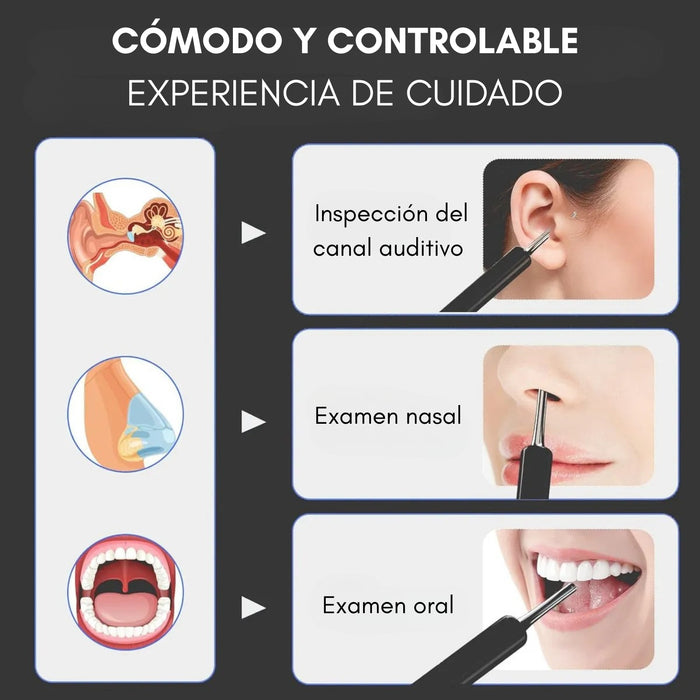Limpia Oídos Cámara Inteligente Extractor De Cera Endoscopio