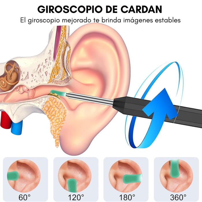 Limpia Oídos Cámara Inteligente Extractor De Cera Endoscopio