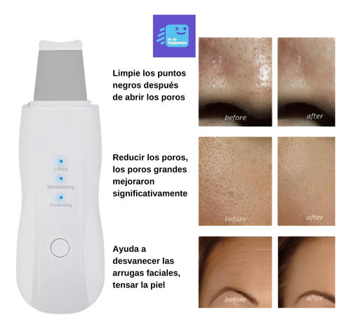 Limpiador Ultrasonico Masaje Facial Digital Peeling Lifting